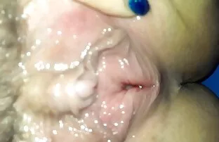XXX نوعی سرطان گربه عکس سکسی باسن گنده چربی
